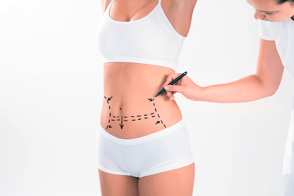 Tummy Tuck Complication Treatment