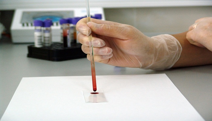 Global Hemoglobin Testing Market – Industry Trends