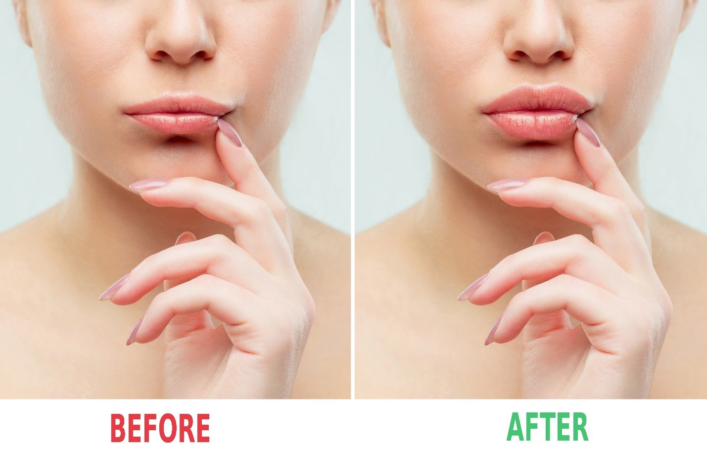 Everything you need to know about Juvederm dermal fillers.