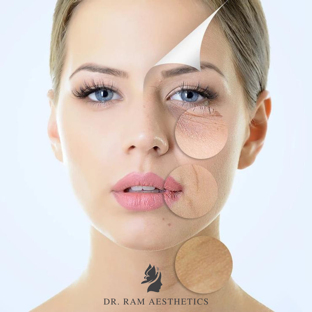 Dermal filler clinic isle of man