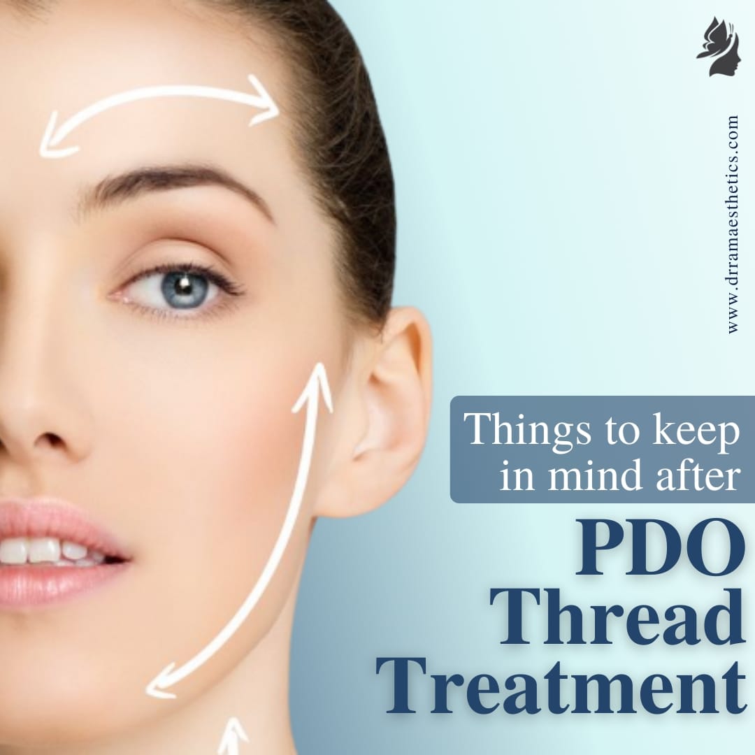 PDO Thread lift in isle of man