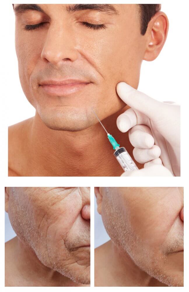 Profhilo Clinic in Isle of Man