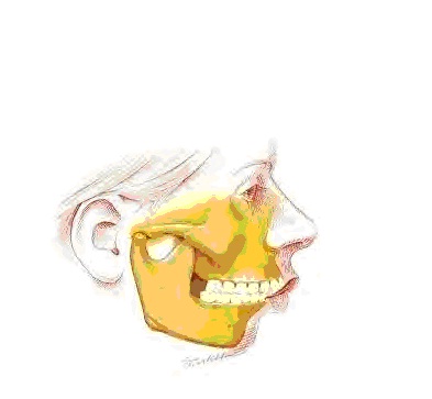 What is Orthognathic Surgery?