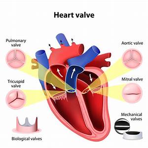 What is a Bioprosthetic Valve?