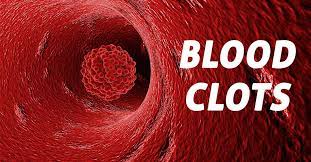 What is a blood clot?