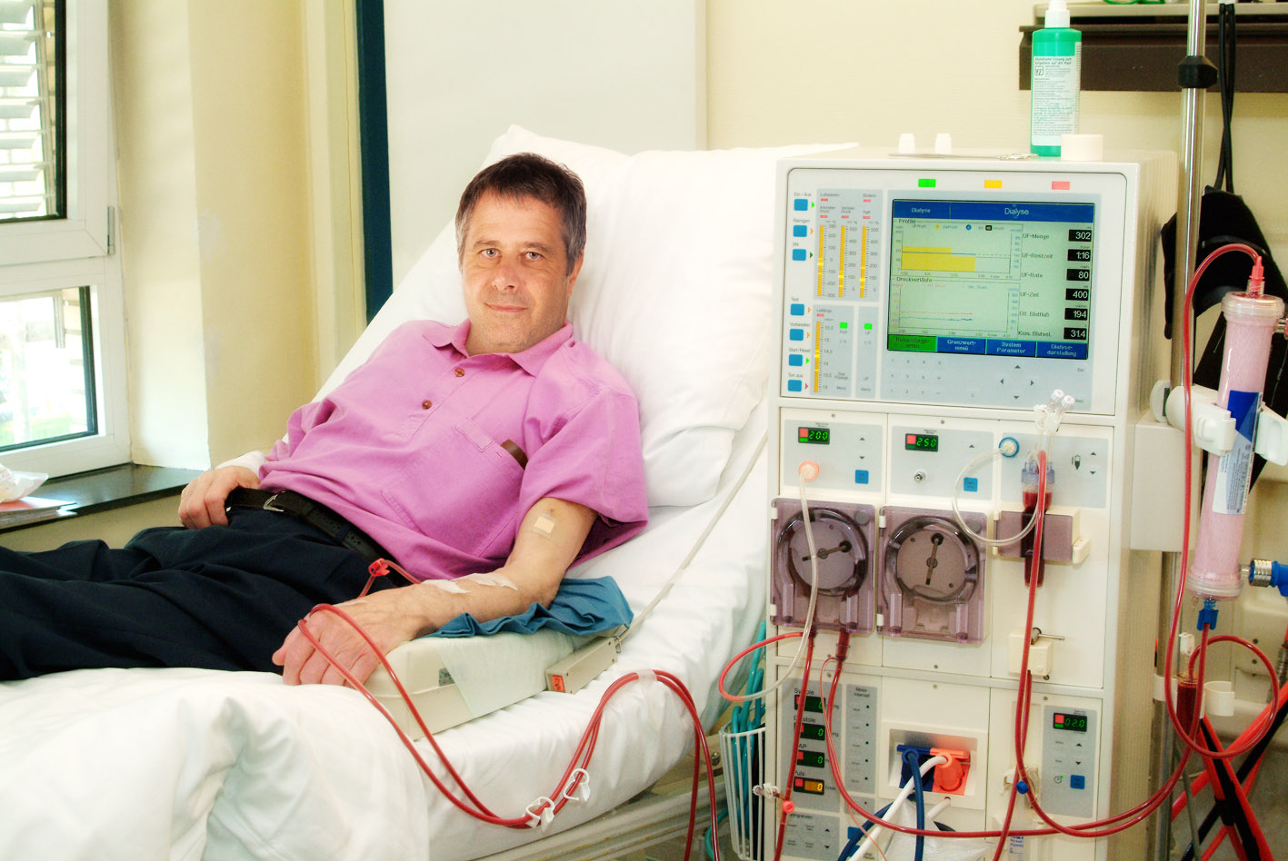 Kidney Dialysis Equipment Market Grow with CAGR of 5.34% | Focuses on Top Companies, Region and Opportunities 2027