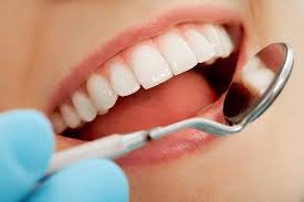 A Brief Information on Dental Veneers Melbourne