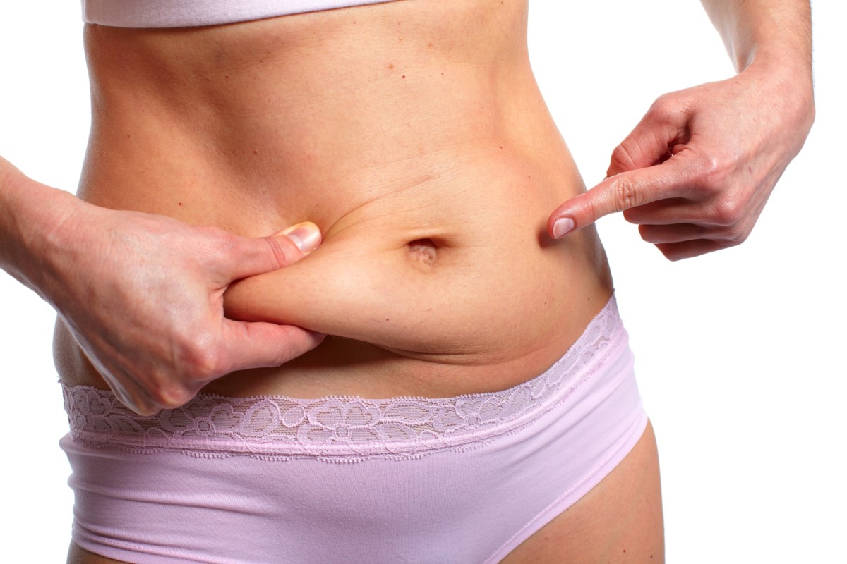Tummy tuck Chennai