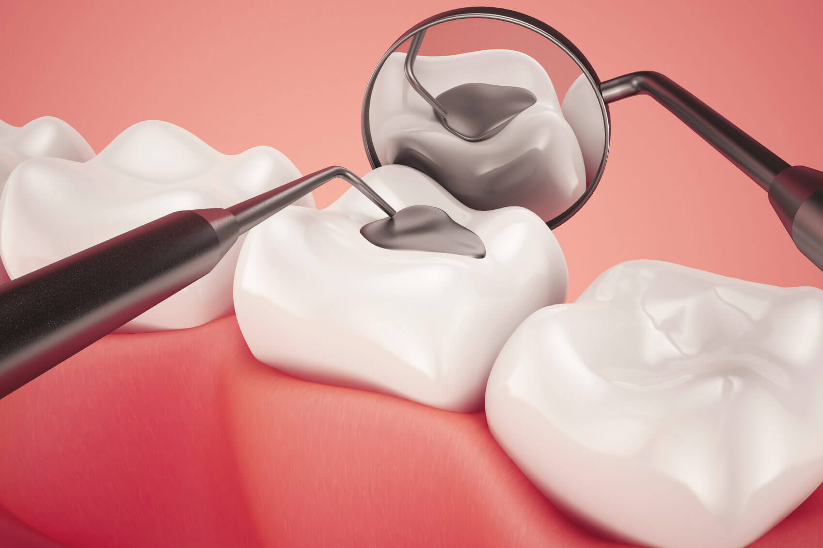 Know Expert tips to make the last tooth-filling last