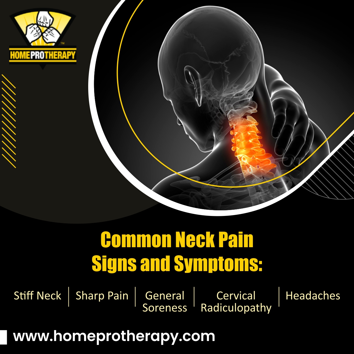 Shoulder Pain Treatment Virginia