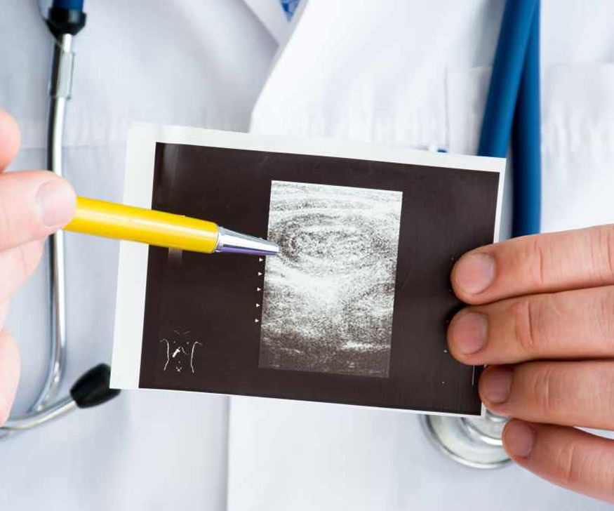 Stomach Doctor in Thane