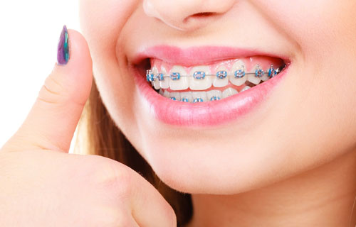 Tricks to select right orthodontist for you