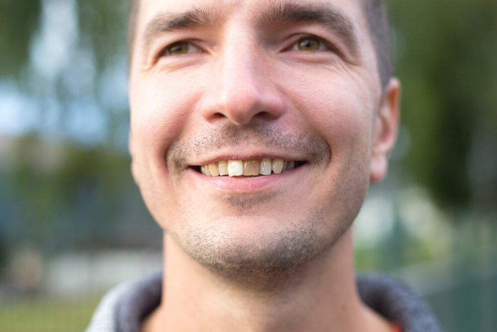 Say Goodbye To Missing Teeth With Dental Implants Near Me At Tuxedo Dental