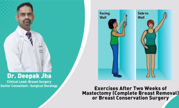 Breast Cancer Surgery in Delhi