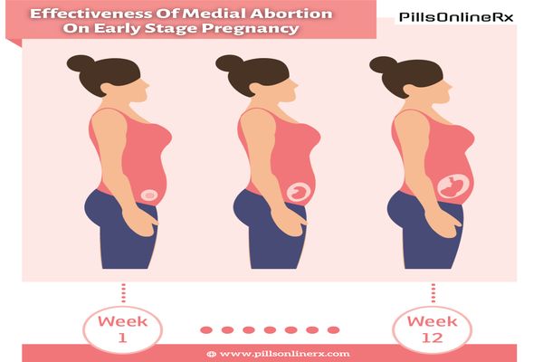 Effectiveness Of Medial Abortion On Early Stage Pregnancy