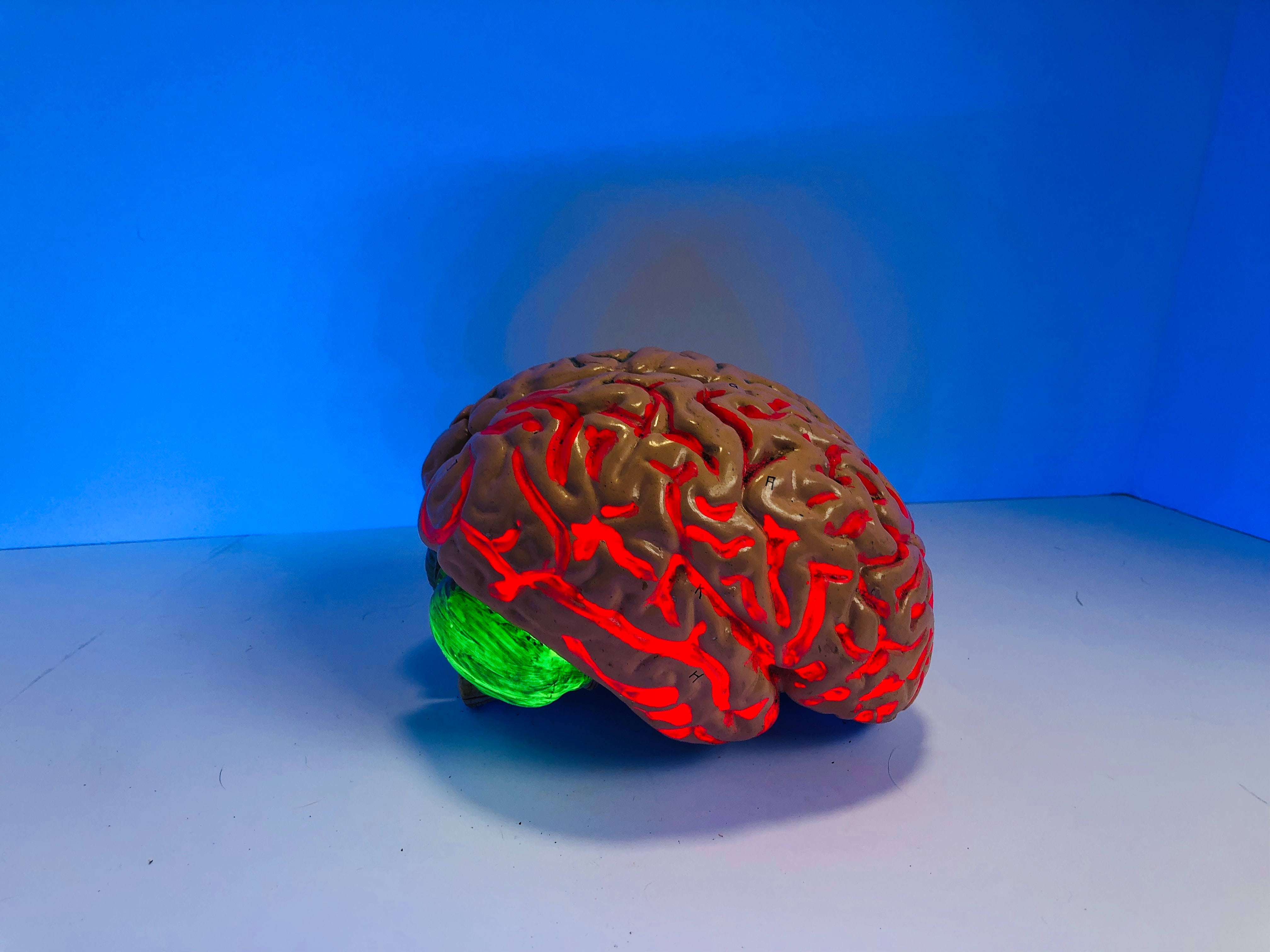What Wikipedia won’t tell you about Optogenetics Market