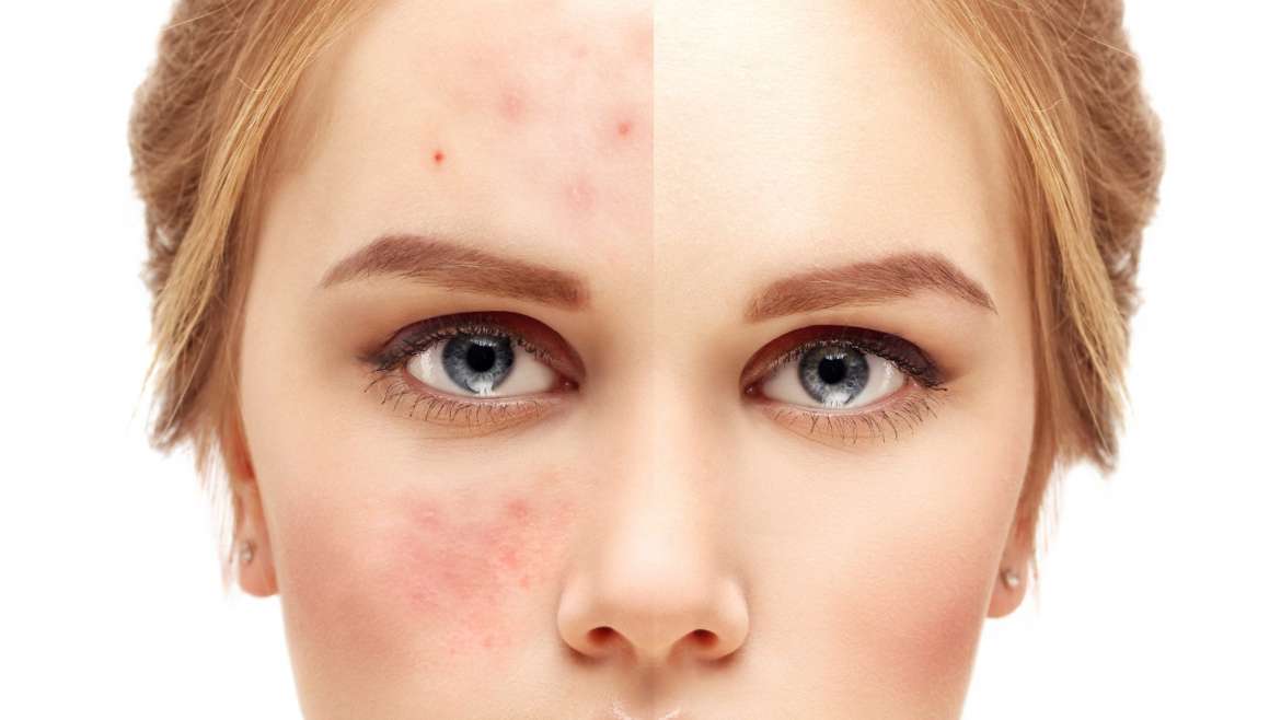 We are the best place to shop for the most delicate skincare products in Leicester.