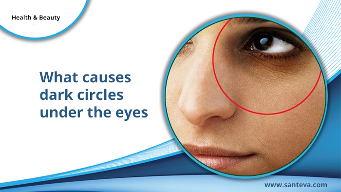 What Causes Dark Circles Under Your Eyes
