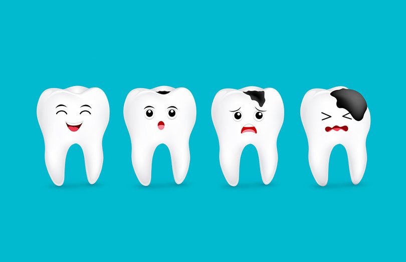 Tooth Decay: What is It, and How Can You Deal with It?
