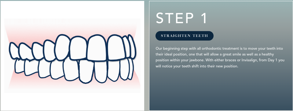  4 Most Practical Reasons Why You Need to Consult with an Orthodontist