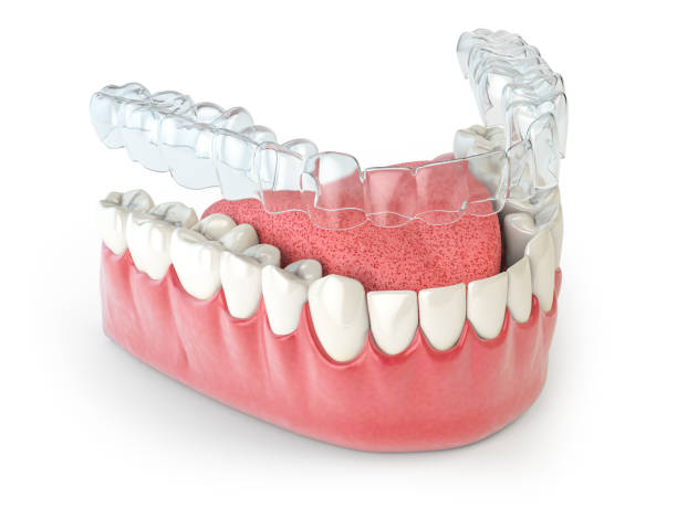 Invisalign and Confidence: How a Clear Smile Boosts Self-Esteem