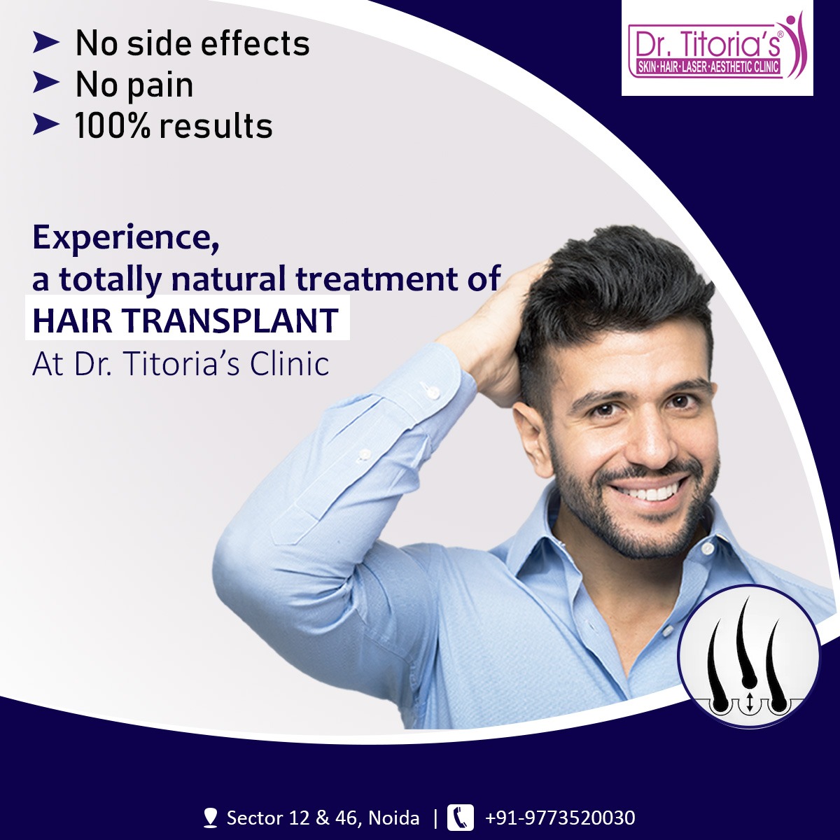 Hair Transplant vs Other Hair Restoration Treatments: Which One is Right for You?