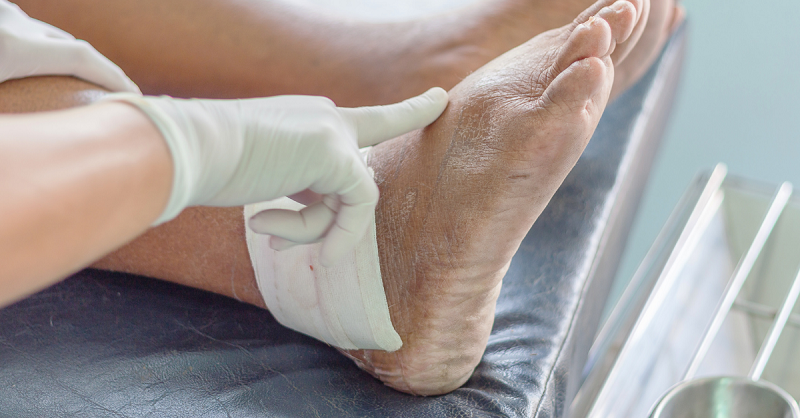 Are There Any Complexities In Venous Leg Ulcers?