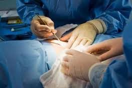 Weight Loss Surgery Bariatric Costs in Mexico