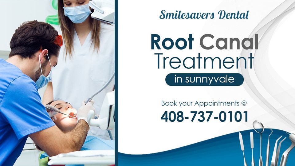 Root Canal Treatment | Smilesavers Dental