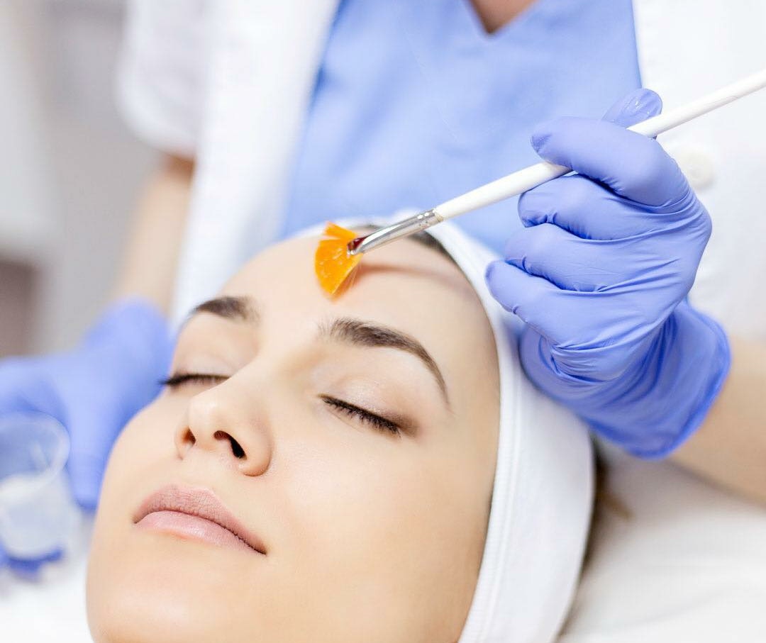 Is Chemical Peel good For Skin?