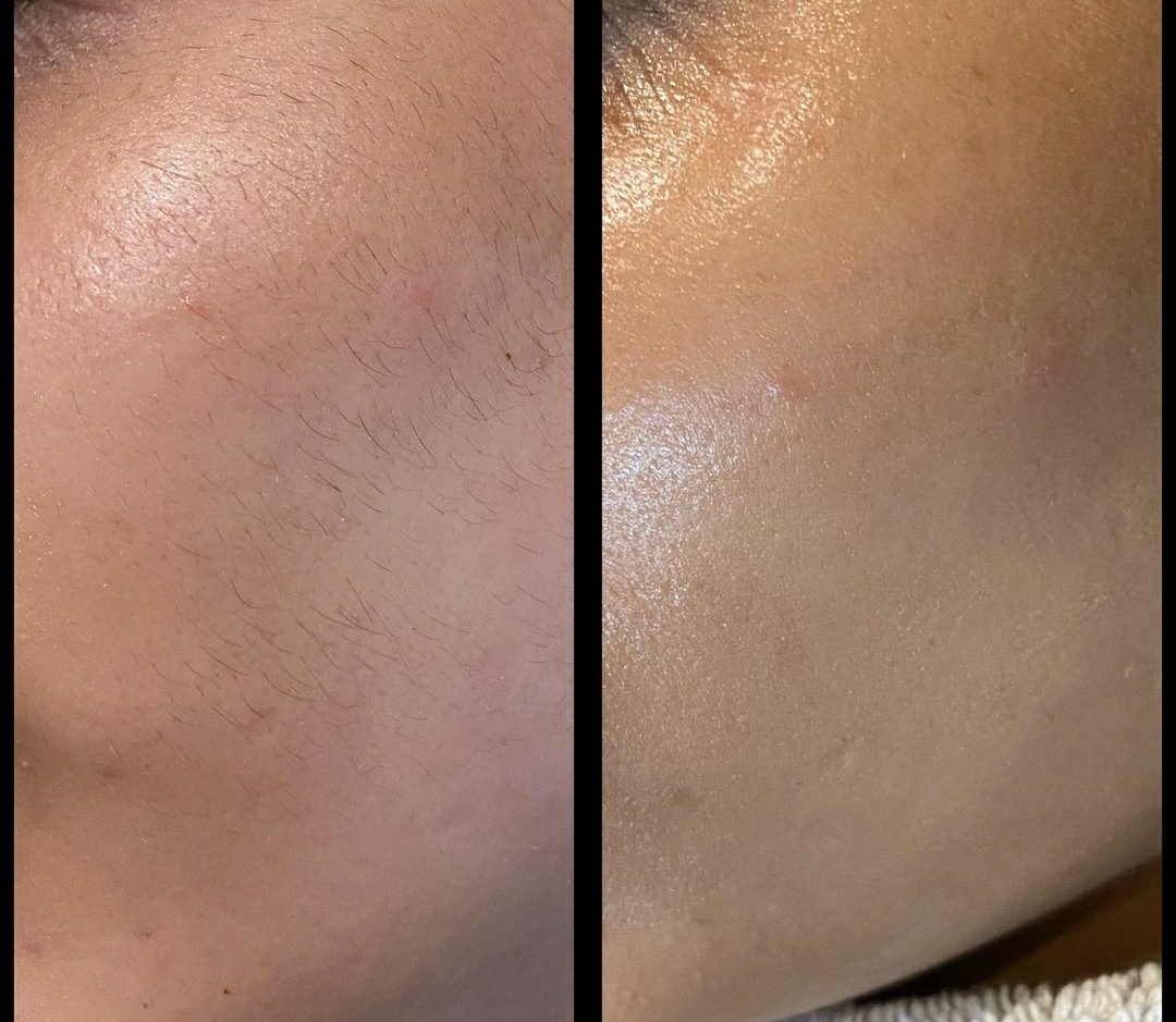 Why Is BB Glow Going Viral