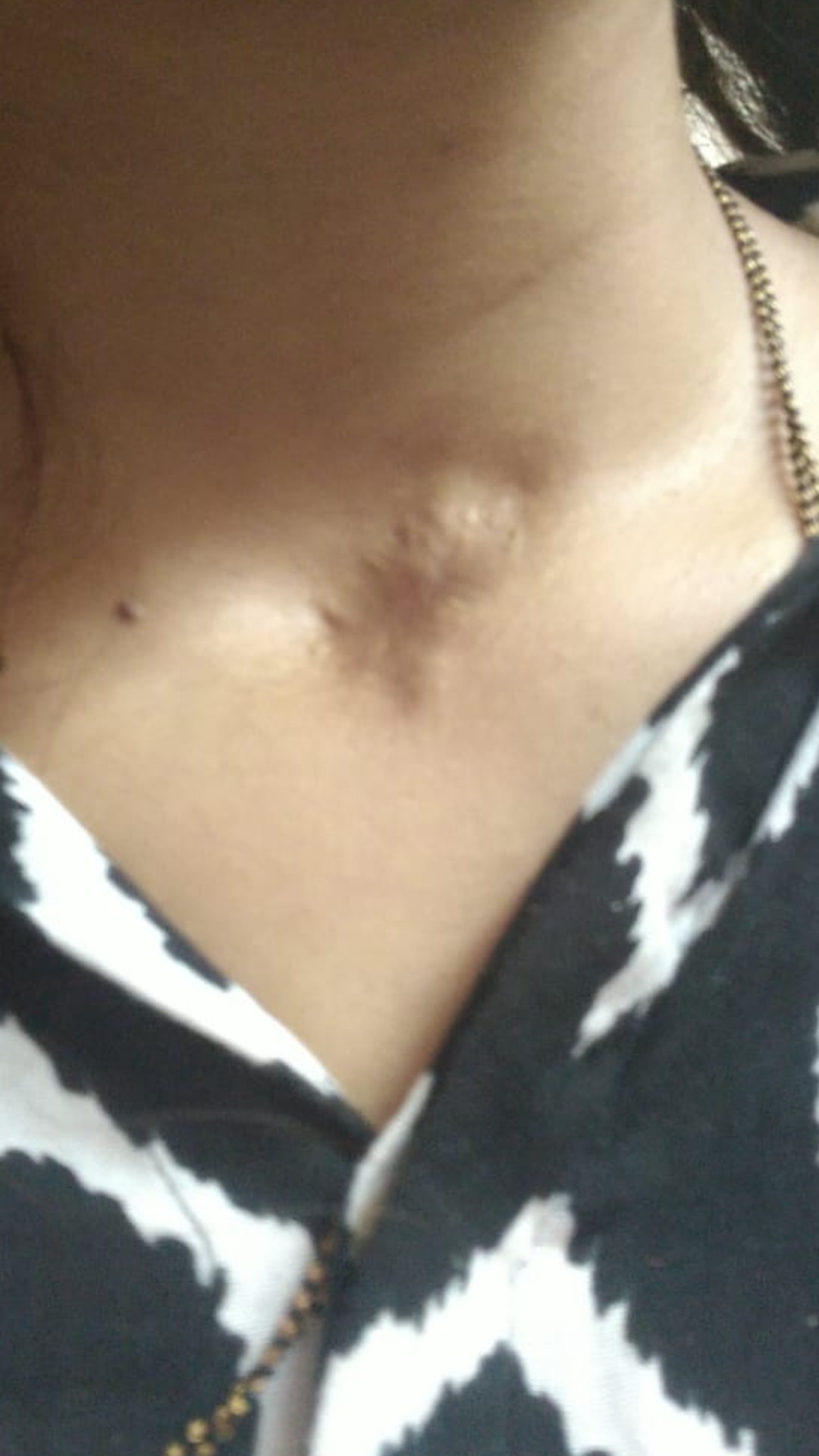 What Can You Do About Skin Cancer