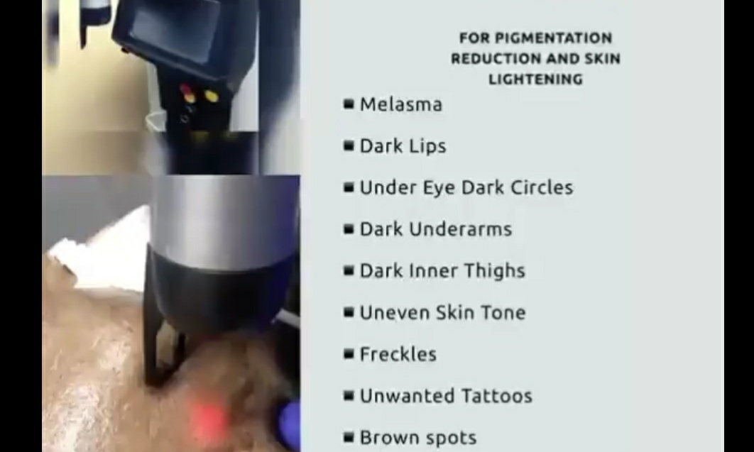 7 Reasons Alma Q Laser Is Best for skin