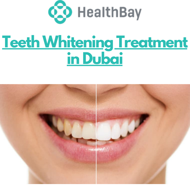 We Offer the Best Teeth Whitening Treatment in Dubai - Health Bay