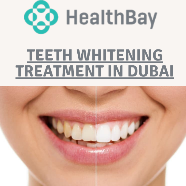 Top Teeth Whitening Treatment in Dubai - Health Bay