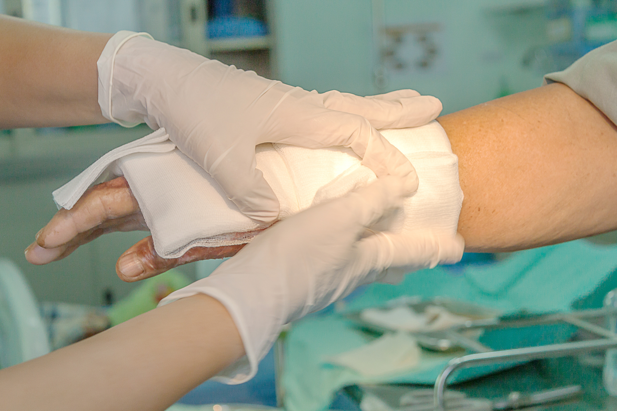 Are Burn Injury Lawyers Worth Your Money & Time?