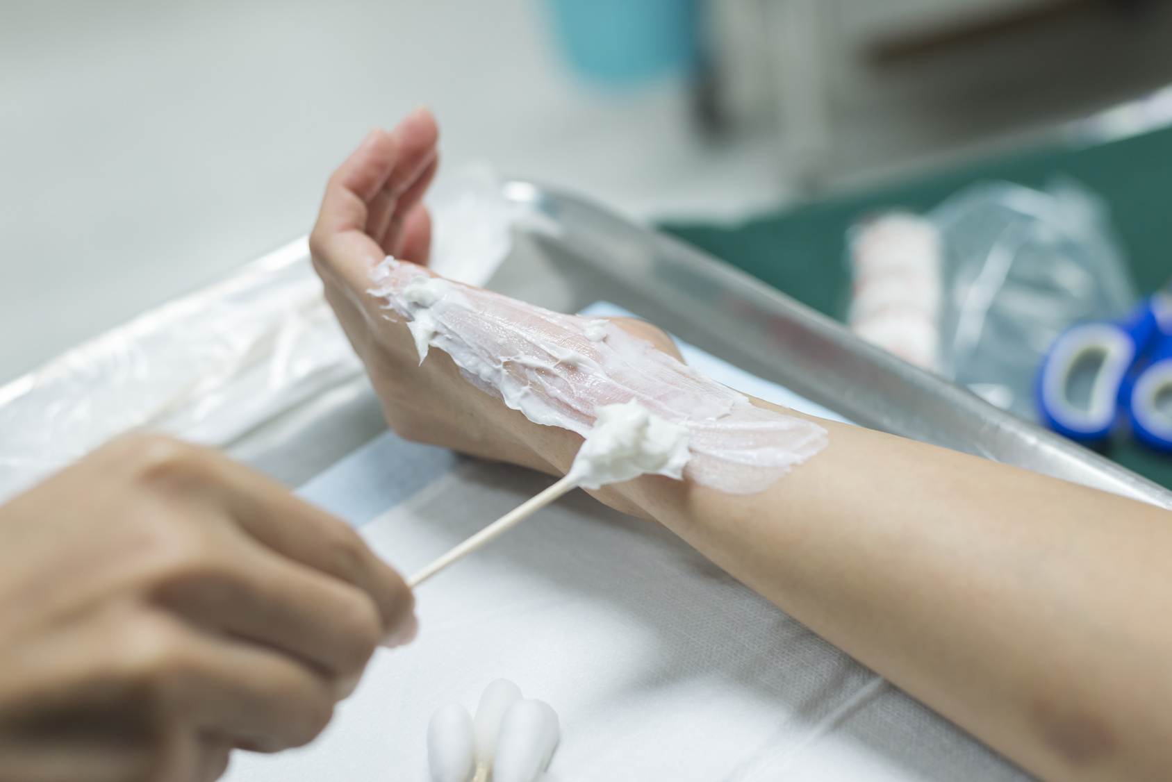 What Every Florida Resident Should Know About Burn Injury Law