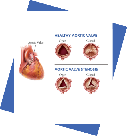 Stress Echo services california