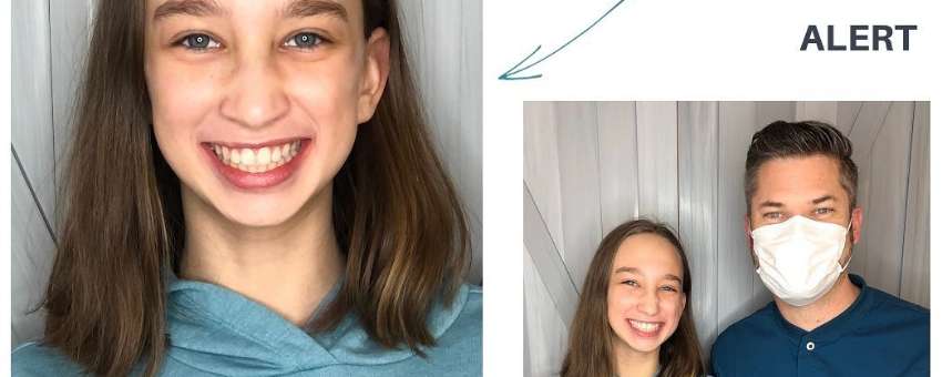 Why Correction of Orthodontic Problems in Adults is Important?