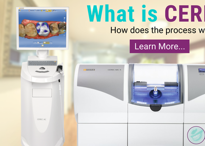 What is CEREC?