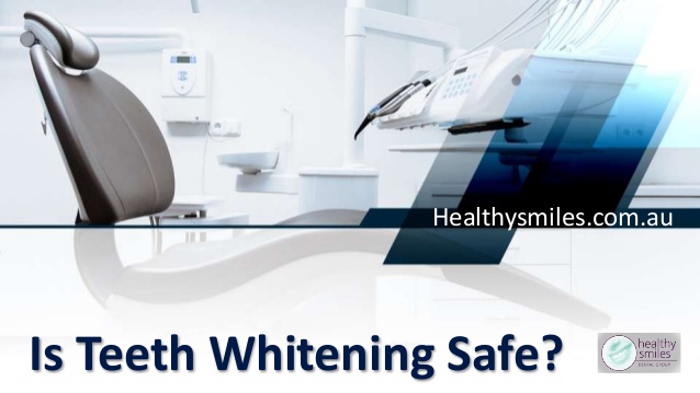 Is Teeth Whitening Safe? - Healthy Smiles Dental Group