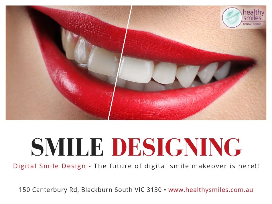 Digital Smile Design at Healthy Smiles