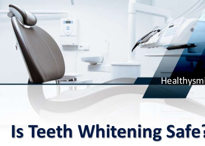 Is Teeth Whitening Safe? - All You Need To Know About