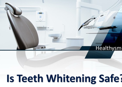 Is Teeth Whitening Safe?