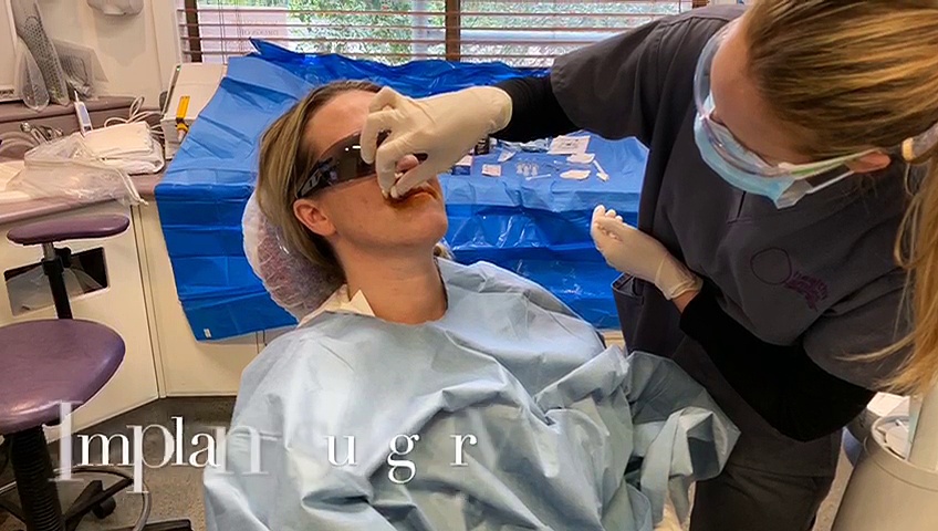 Dental Implants Surgery at Healthy Smiles