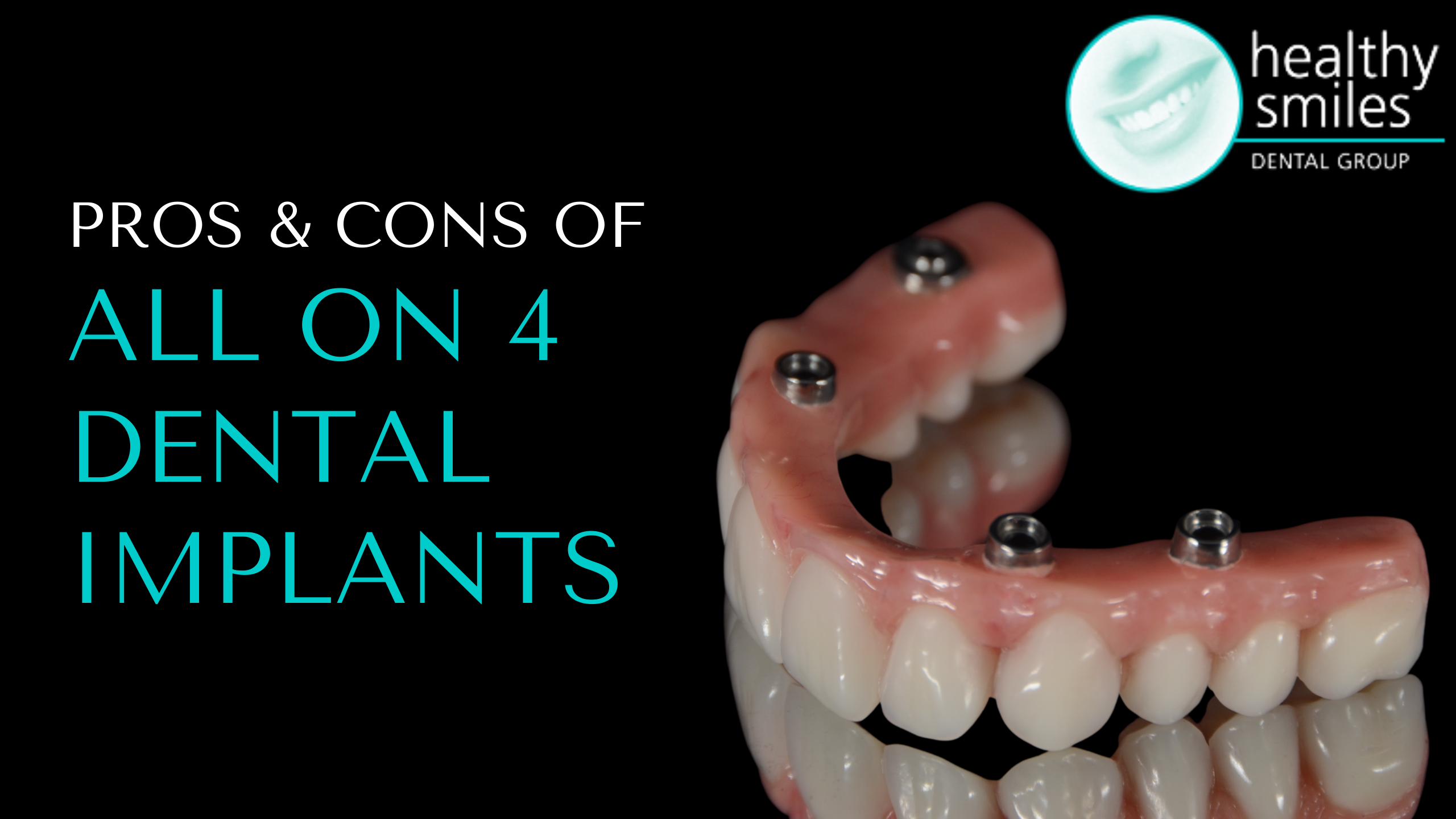 Pros and Cons of All-on-4 Dental Implants