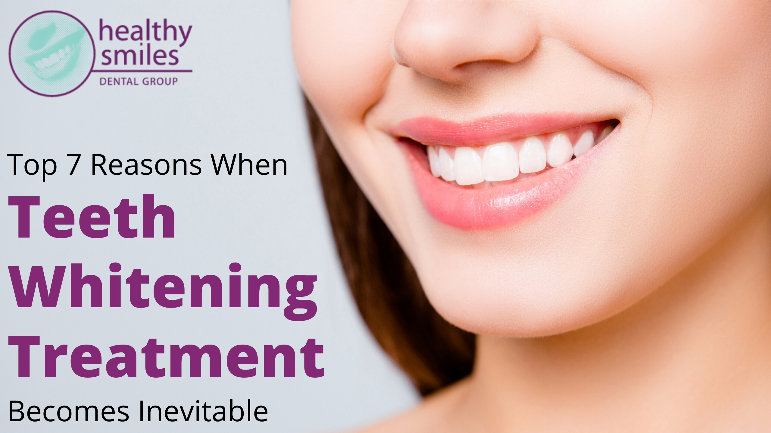 Top 7 Reasons When Teeth Whitening Treatment is Inevitable