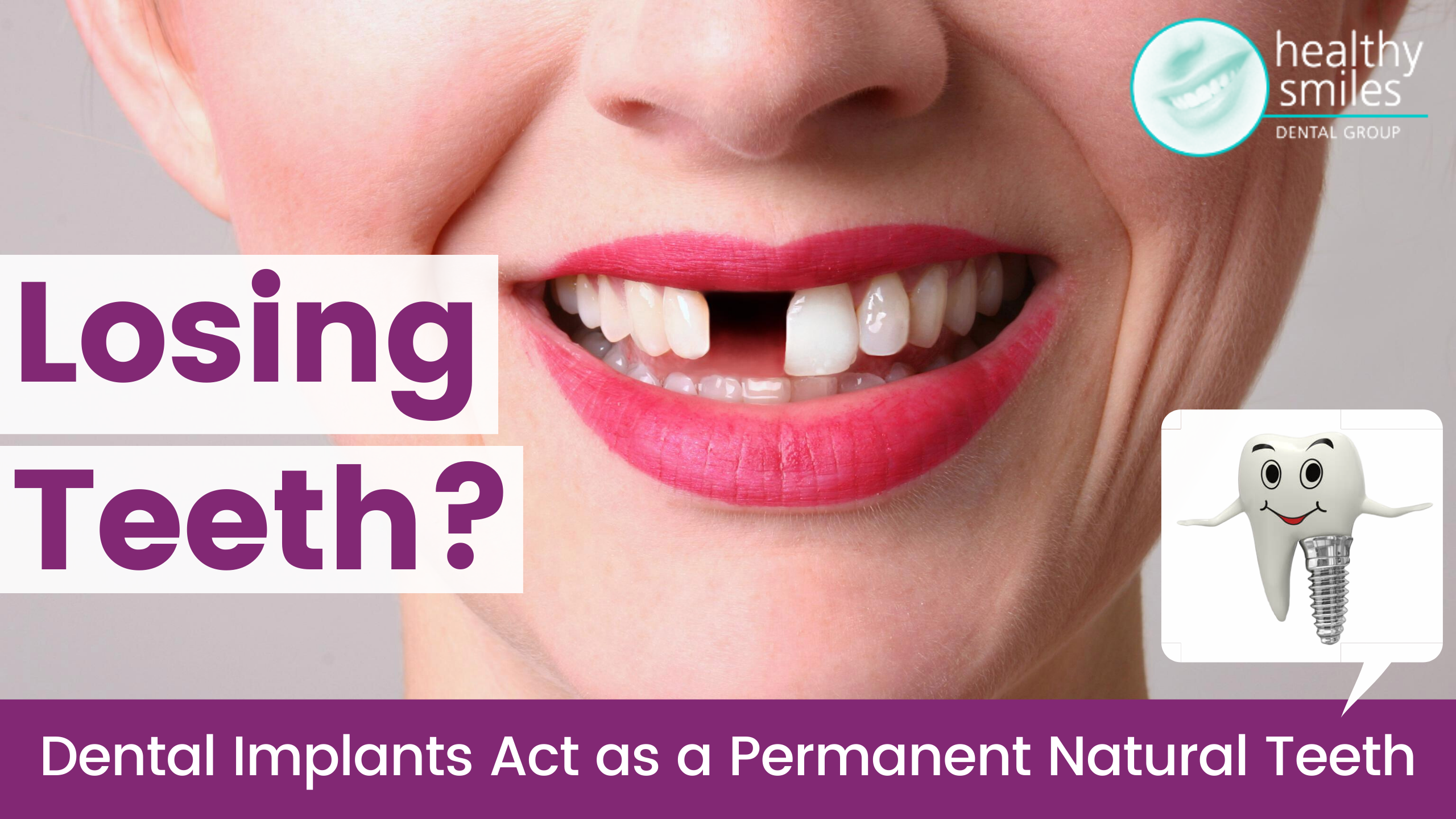 Losing Teeth? Dental Implants Act as a Permanent Natural Teeth