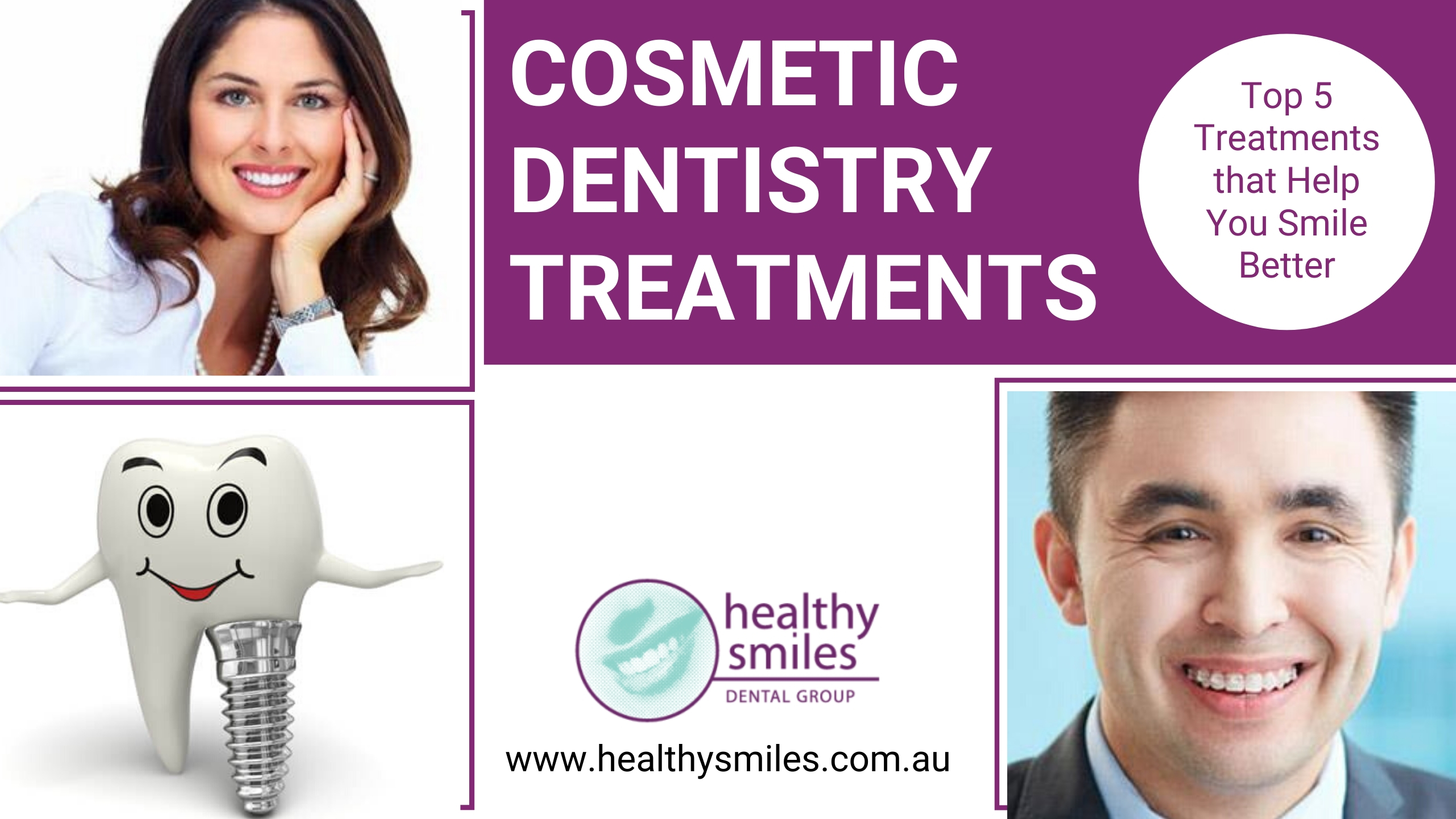 Top 5 Cosmetic Dental Treatments That Help You Smile Better