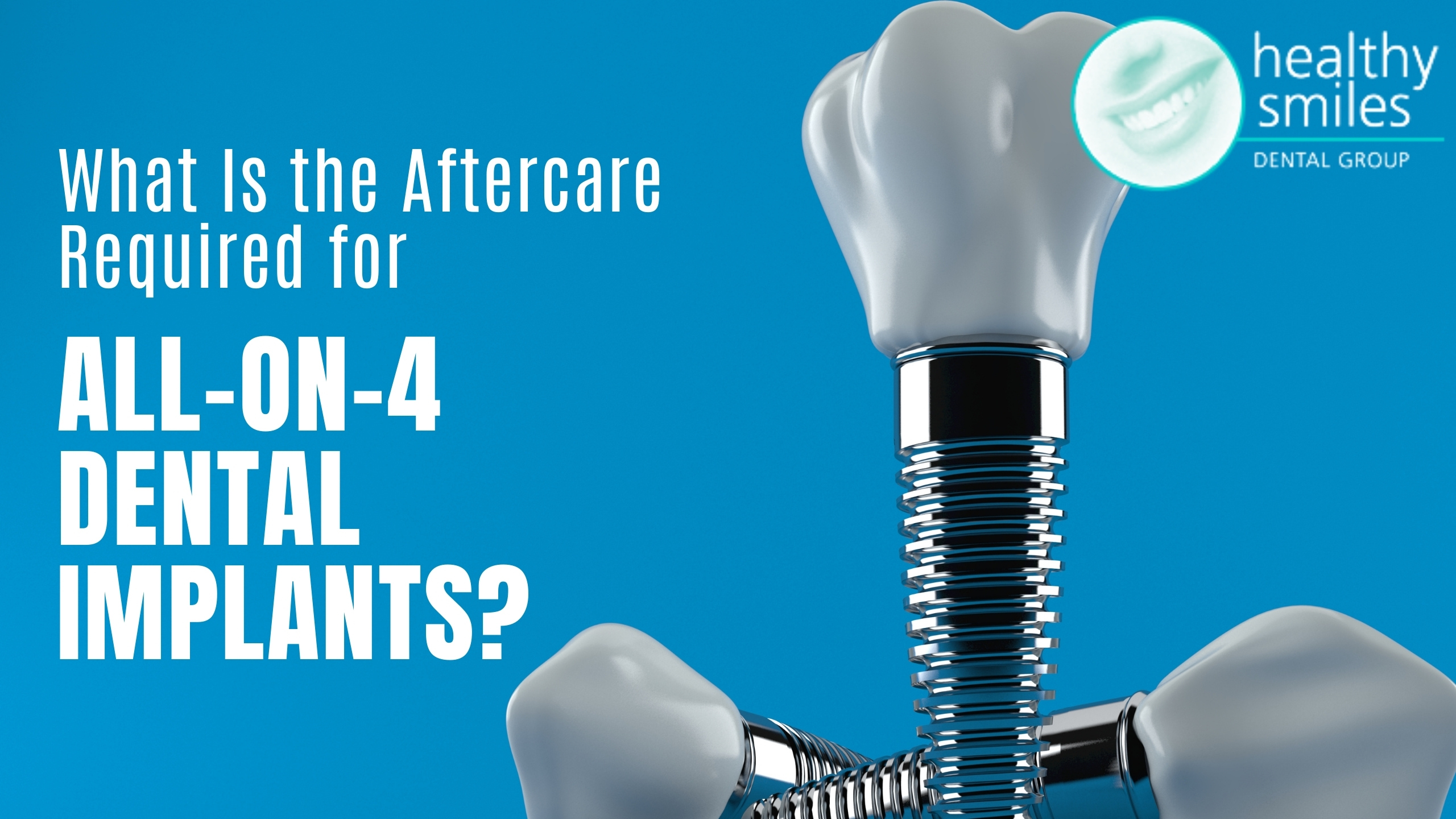 What is the Aftercare Required for All-on-4 Dental Implants?